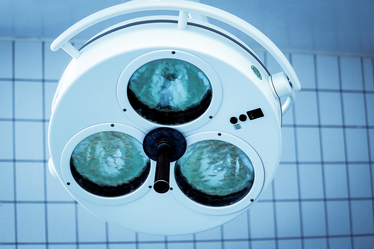 如何进行竞争对手分析以提高排名